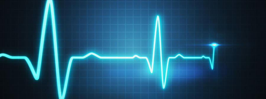 ECG Trace